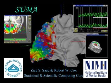 SUMA - the AFNI/NIfTI Server