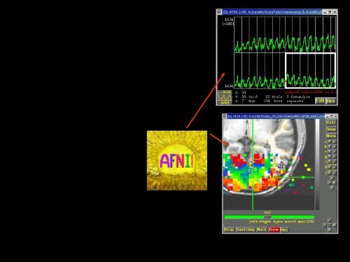 SUMA - the AFNI/NIfTI Server