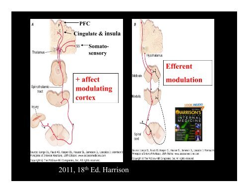 Neurobiology of Somatization