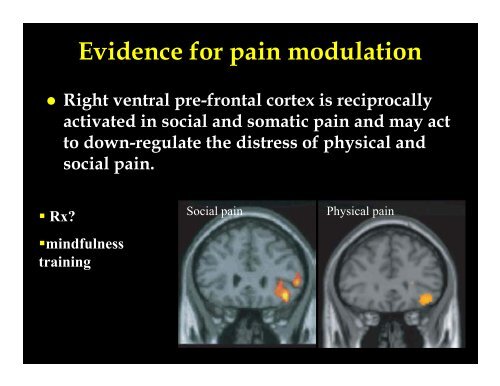 Neurobiology of Somatization