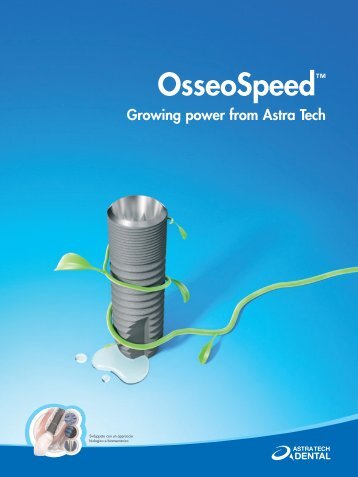 astra Osseospeed 3, page 1-20 @ Normalize - Astra Tech