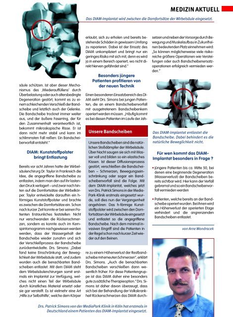 2) DIAM, UnterstÃ¼tzung der Bandscheibe - Neurochirurgie KÃ¶ln in ...