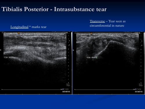 Diagnostic Ultrasound of the Ankle and Foot