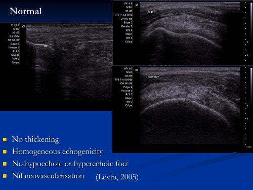 Diagnostic Ultrasound of the Ankle and Foot