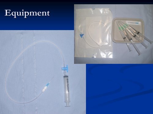 Diagnostic Ultrasound of the Ankle and Foot