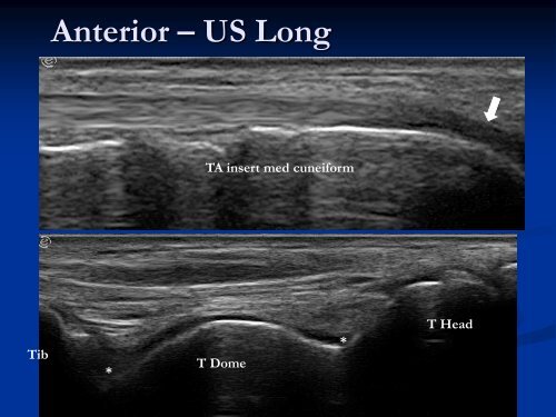 Diagnostic Ultrasound of the Ankle and Foot