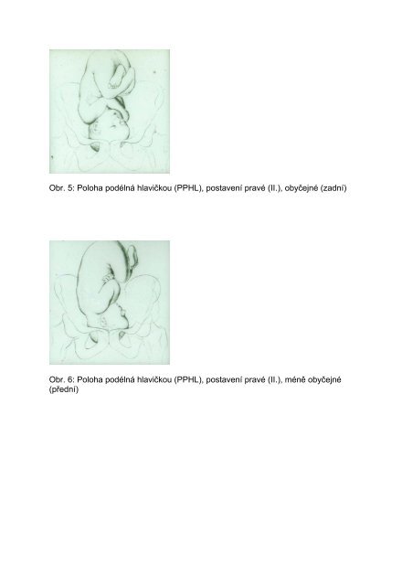 Uložení plodu v děloze na konci těhotenství - eAMOS