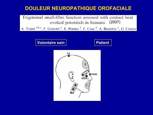 Exploration de la sensibilitÃ© thermo-algÃ©sique par les Potentiels ...