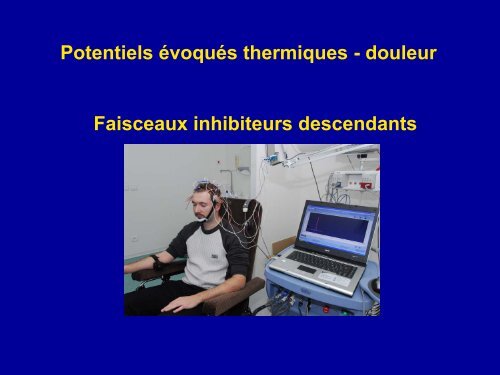 Exploration de la sensibilitÃ© thermo-algÃ©sique par les Potentiels ...