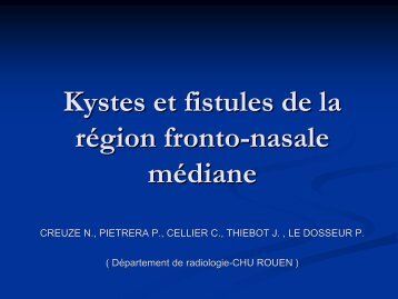 Kystes et fistules de la rÃ©gion fronto-nasale mÃ©diane