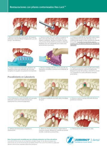 Restauraciones con pilares contorneados Hex-Lock - Zimmer Dental