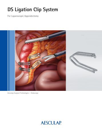 DS Ligation Clip System - Aesculap