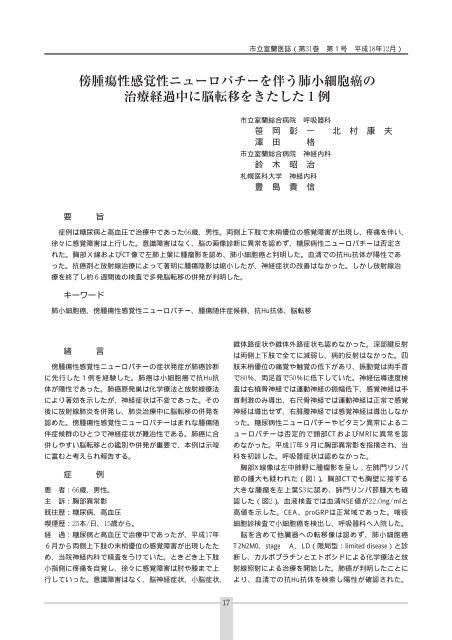 傍腫瘍性感覚性ニューロパチーを伴う肺小細胞癌の 札幌医科大学
