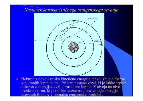 I Rentgenska svetloba - F9