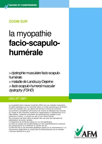 la myopathie facio-scapulo- humérale - ASRIM
