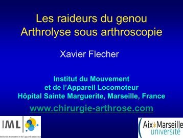 Arthrolyse sous arthroscopie - S. Flecher