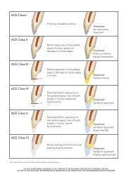 ACE Class I ACE Class II ACE Class III ACE Class IV ... - OSTEOCOM