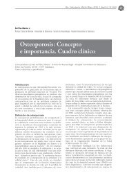 Osteoporosis: Concepto e importancia. Cuadro clÃ­nico - Revista de ...