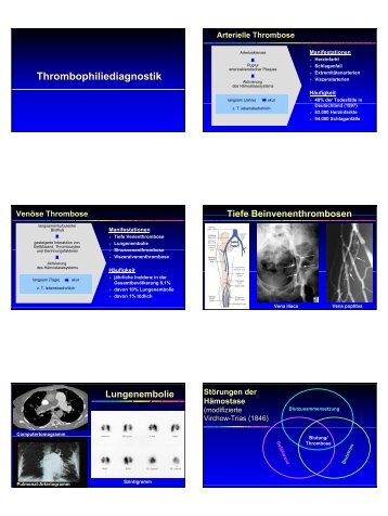 Thrombophiliediagnostik