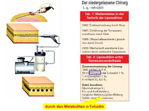 Präsentation [pdf] - Helmholtz Zentrum München