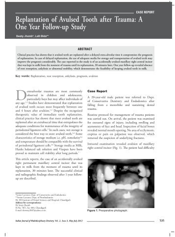 Replantation of Avulsed Tooth after Trauma: A One Year ... - IJMD