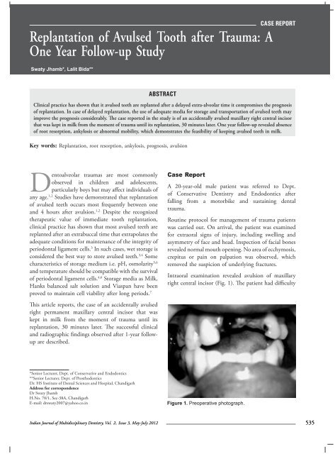 Replantation of Avulsed Tooth after Trauma: A One Year ... - IJMD