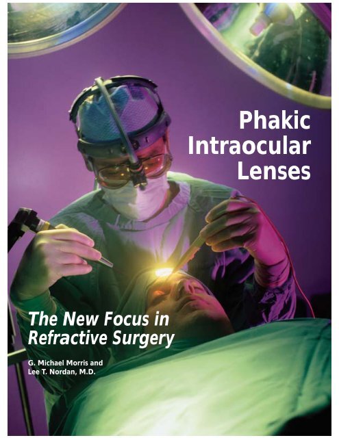 Phakic Intraocular Lenses - Apollo Optical Systems