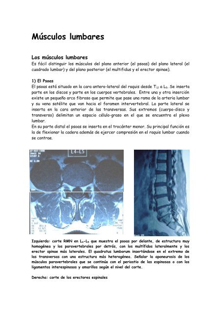 Raquis Lumbar - sofmmoo