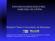 ESTUDIO RADIOLÓGICO DEL SARCOMA DE EWING Hospital ...