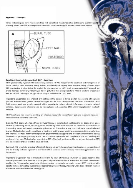 Tarlov Cyst - HyperMED