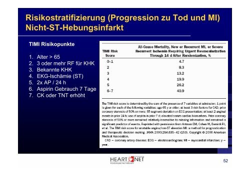 Akutes Koronarsyndrom - Scopri.ch