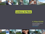 Lambeau de fibula - e-plastic.fr