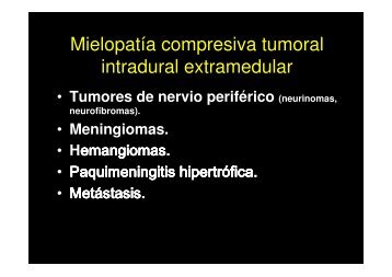 Mielopatía compresiva tumoral intradural extramedular