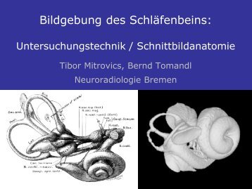 Neuroradiologische Diagnostik bei Demenzerkrankungen