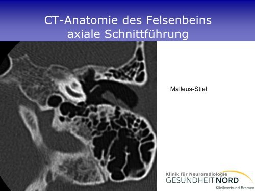 Neuroradiologische Diagnostik bei Demenzerkrankungen