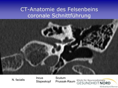 Neuroradiologische Diagnostik bei Demenzerkrankungen