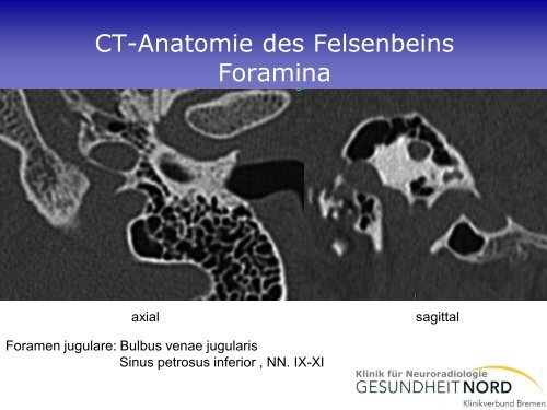 Neuroradiologische Diagnostik bei Demenzerkrankungen