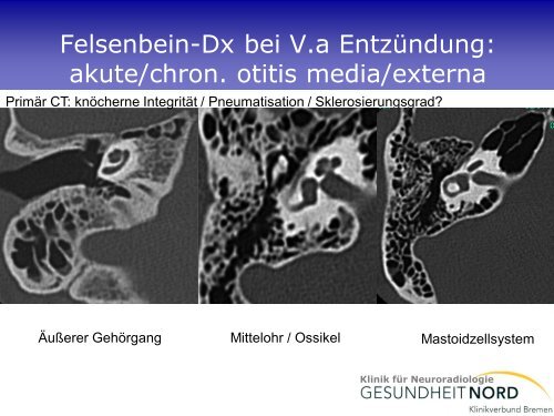 Neuroradiologische Diagnostik bei Demenzerkrankungen