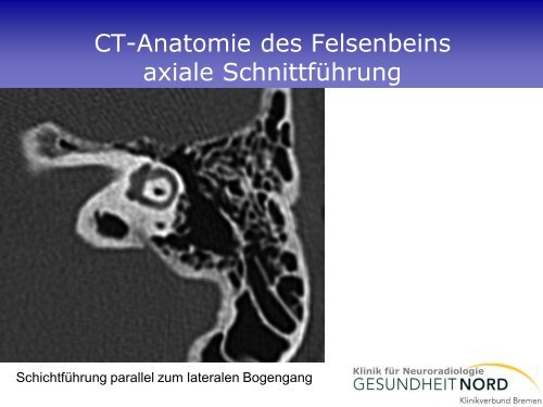 Neuroradiologische Diagnostik bei Demenzerkrankungen