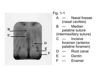 Fig. 1-1 A â Nasal fossae (nasal cavities) B â Median palatine ...