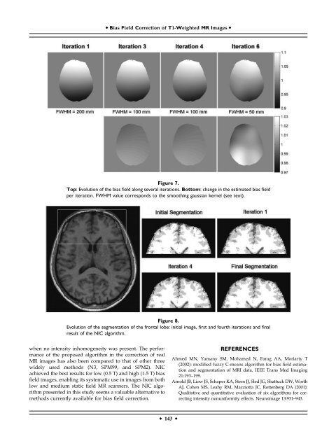 Method for Bias Field Correction of Brain T1-Weighted Magnetic ...