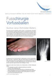 Quintus varus / Schneider-Ballen - in der etzelclinic