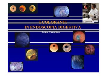 I coloranti in Endoscopia digestiva - EndoscopiaDigestiva.it