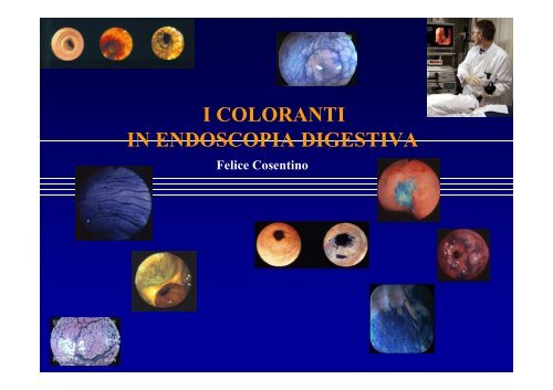 I coloranti in Endoscopia digestiva - EndoscopiaDigestiva.it
