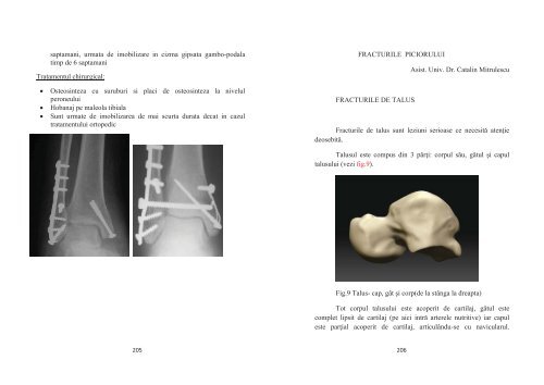 PARTEA I - TRAUMATOLOGIE FRACTURI ... - OvidiusMD