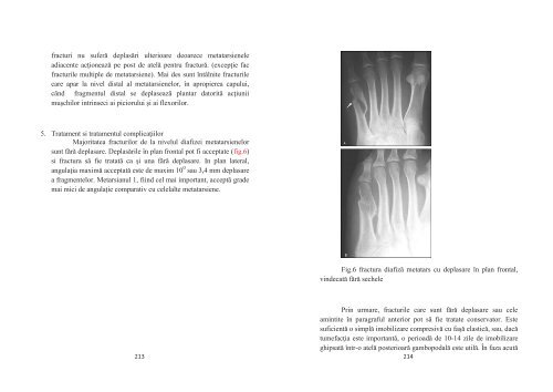 PARTEA I - TRAUMATOLOGIE FRACTURI ... - OvidiusMD