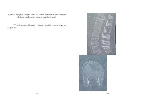 PARTEA I - TRAUMATOLOGIE FRACTURI ... - OvidiusMD