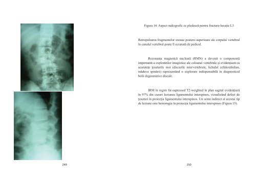 PARTEA I - TRAUMATOLOGIE FRACTURI ... - OvidiusMD