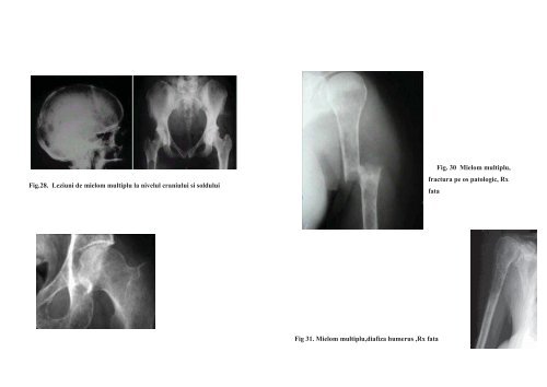 PARTEA I - TRAUMATOLOGIE FRACTURI ... - OvidiusMD