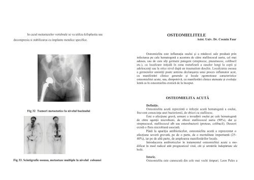 PARTEA I - TRAUMATOLOGIE FRACTURI ... - OvidiusMD